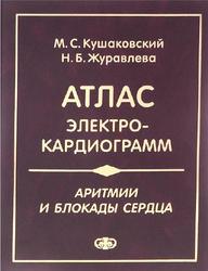 Аритмии и блокады сердца, Атлас электрокардиограмм, Кушаковский М.С., Журавлева Н.Б., 2021