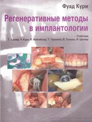 Регенеративные методы в имплантологии, Фуад Кури, 2013